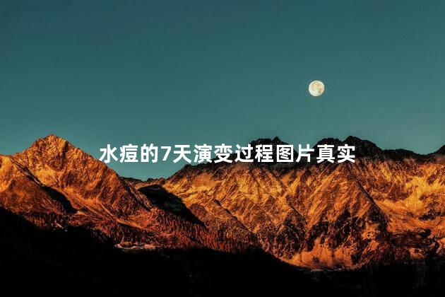 水痘的7天演变过程图片真实